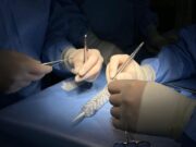 Cirugía inédita en Hospital de La Serena salva la vida de paciente con compleja emergencia aórtica